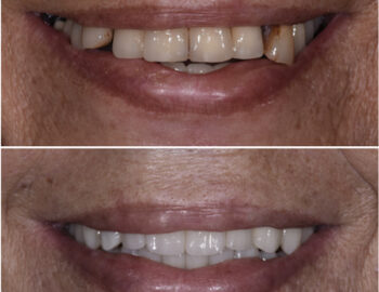 Caso clinico numero 1