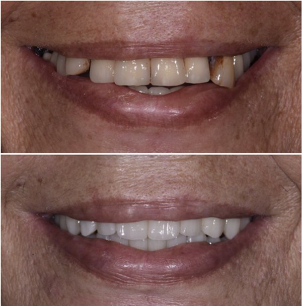 Caso clinico numero 1