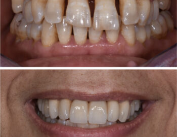 Caso clinico numero 2