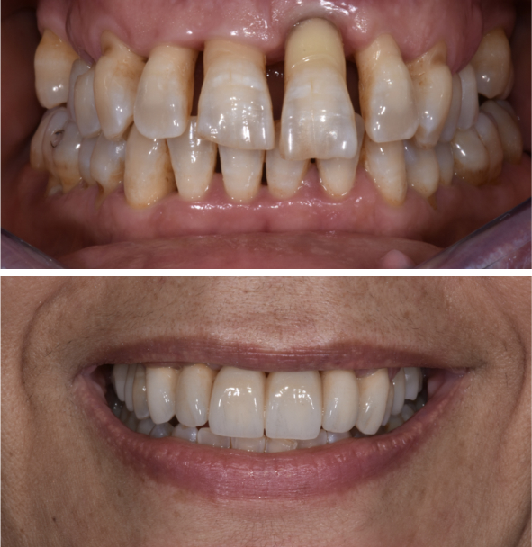 Caso clinico numero 2