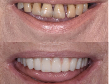 Caso clinico numero 3