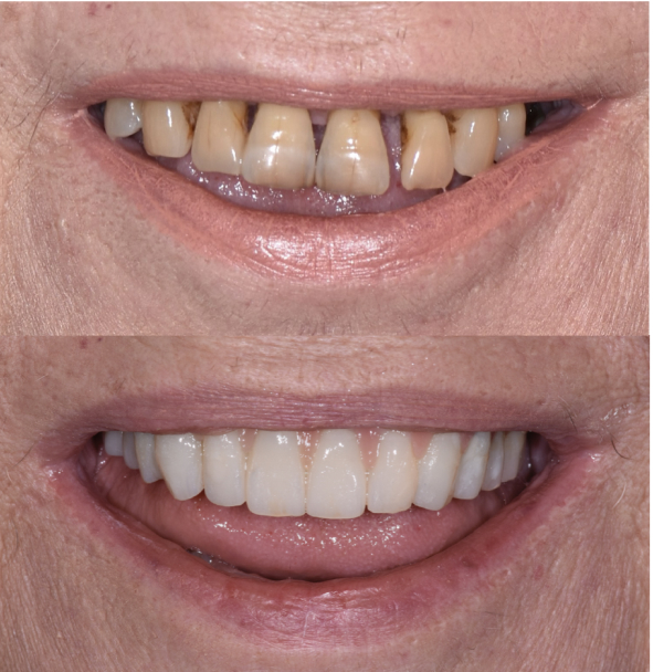 Caso clinico numero 3