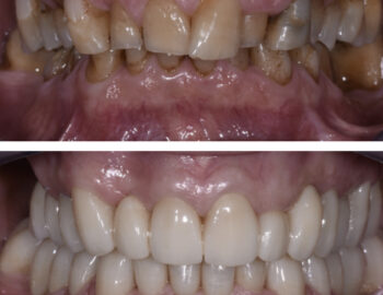 Caso clinico numero 4